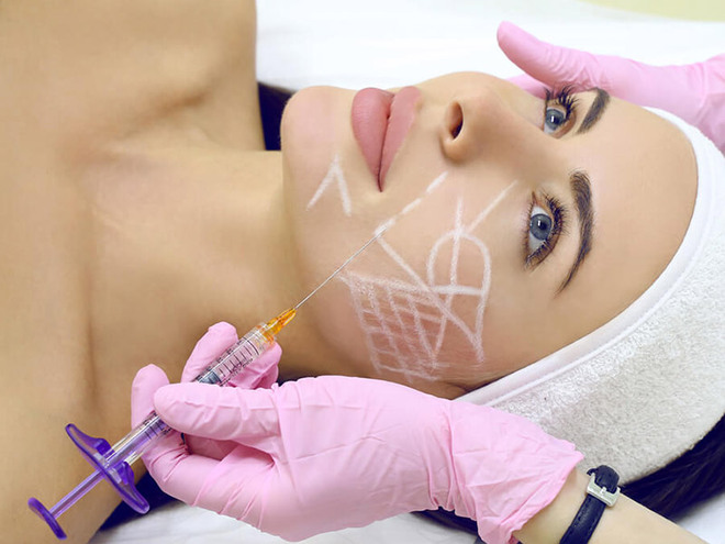 Биоармирование лица: эффективная технология для омоложения и укрепления кожи